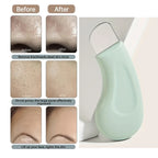 Blackhead and whitehead removal tool, effective for clear skin treatment