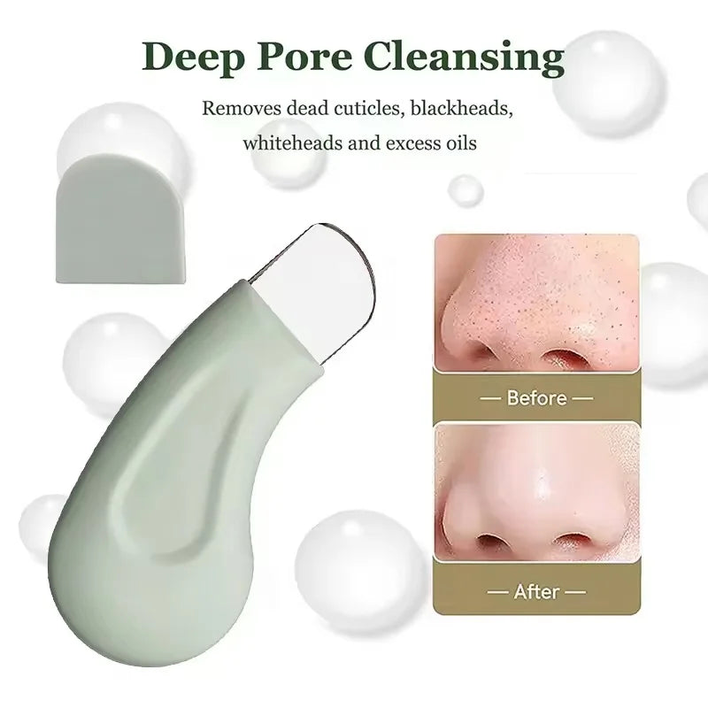 Blackhead and whitehead removal tool for deep pore cleansing
