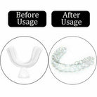 Travel Essentials - Toiletries Four Piece Mouth Guard Teeth Whitening Thermoforming Tooth...
