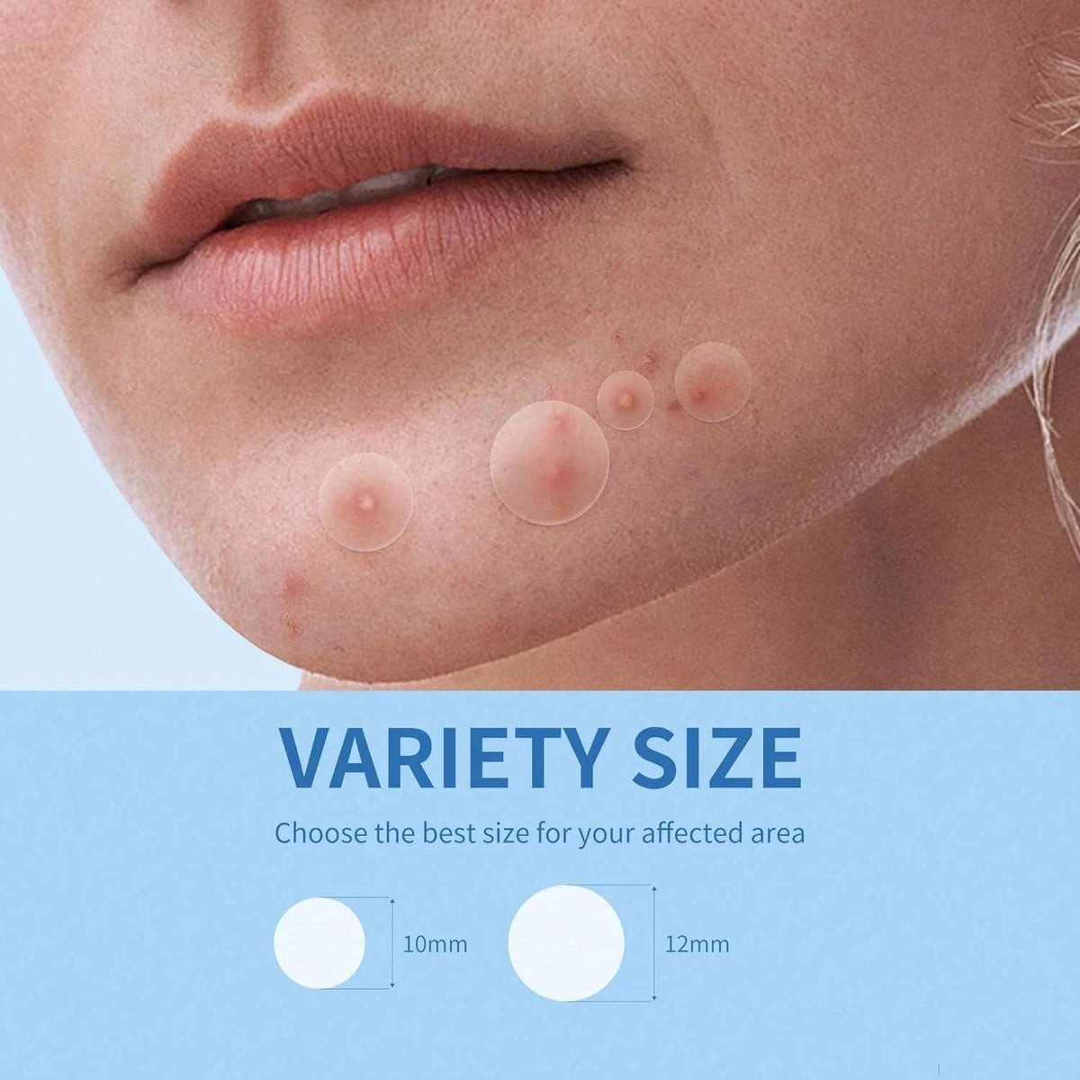 hydrocolloid pimple patch invisible blemish sticker (photo 3 of 10)